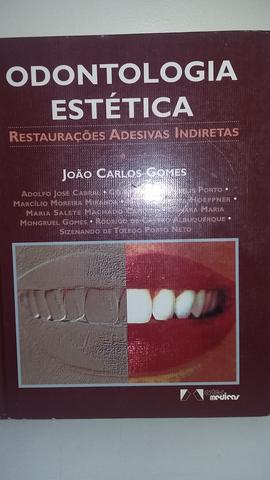 Odontologia Estética Restaurações Adesivas Indiretas