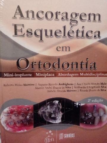 Livro Ortodontia Ancoragem Esquelética